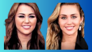 Analyzing Miley Cyrus Plastic Surgery