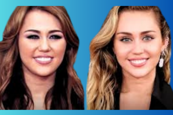 Analyzing Miley Cyrus Plastic Surgery