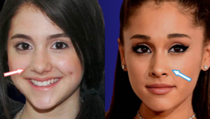 Ariana Grande Plastic Surgery: Before and After Transformation