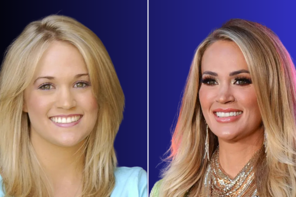 Carrie Underwood Plastic Surgery: Truth Behind Her Transformation