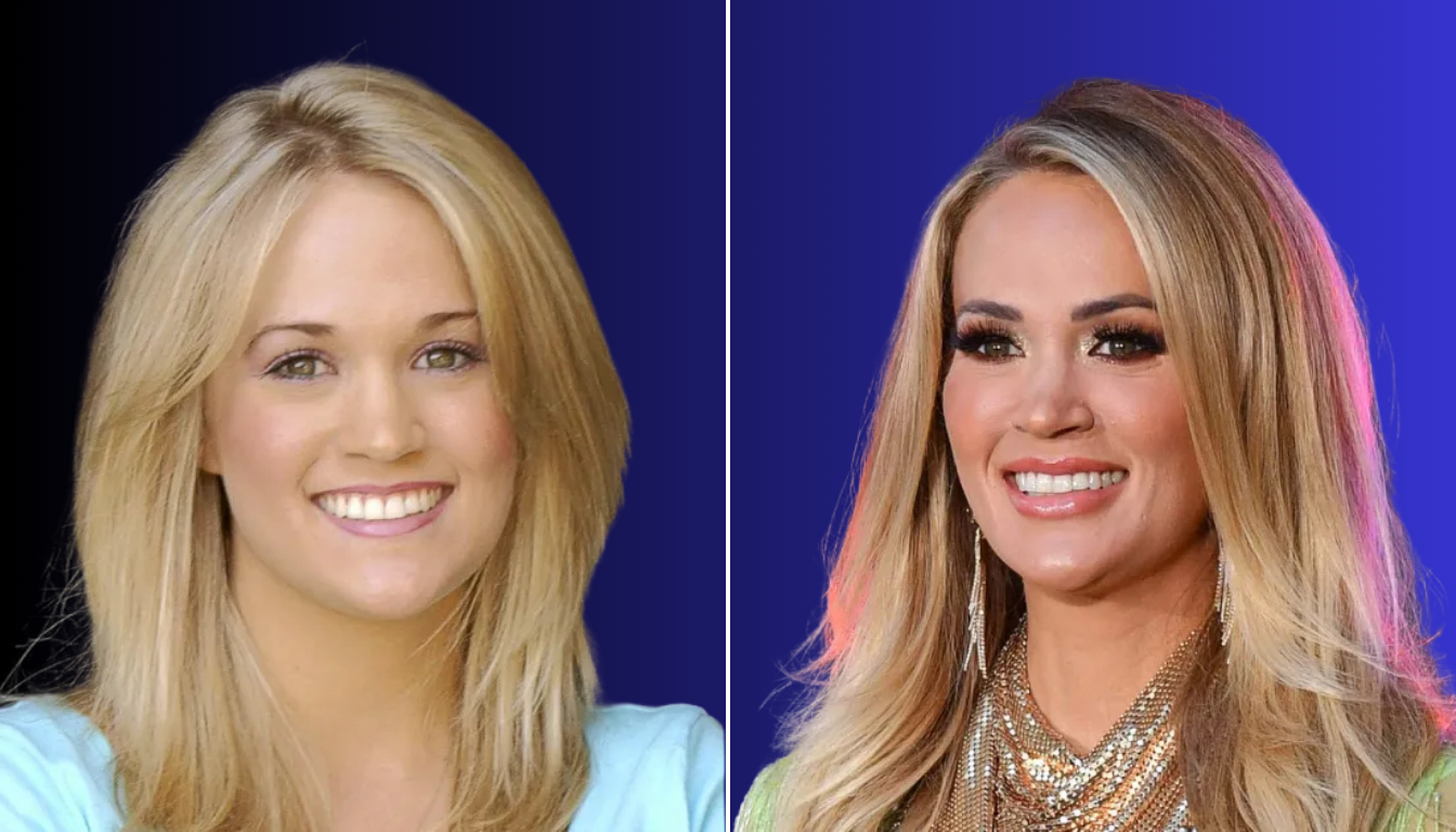 Carrie Underwood Plastic Surgery: Truth Behind Her Transformation