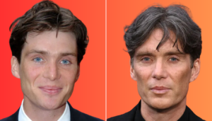 Cillian Murphy Plastic Surgery: Rumors & Speculations Uncovered