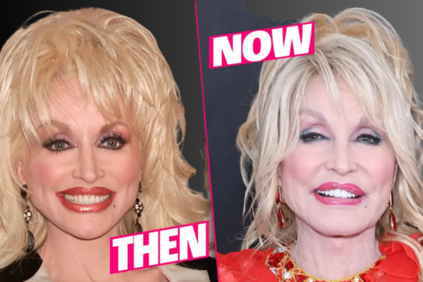 Dolly Parton Plastic Surgery: A Look at Her Transformation Through the Years