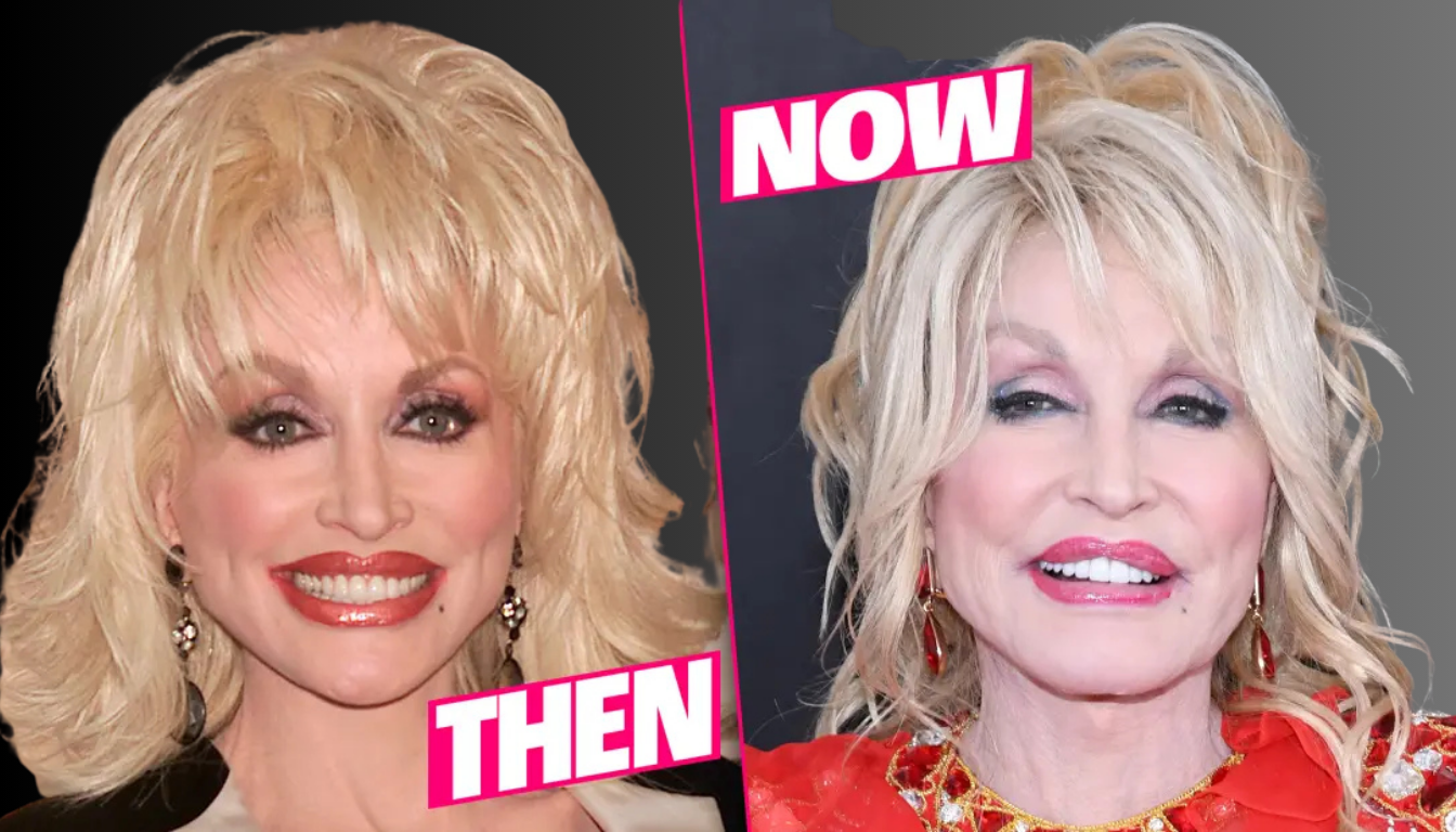 Dolly Parton Plastic Surgery: A Look at Her Transformation Through the Years