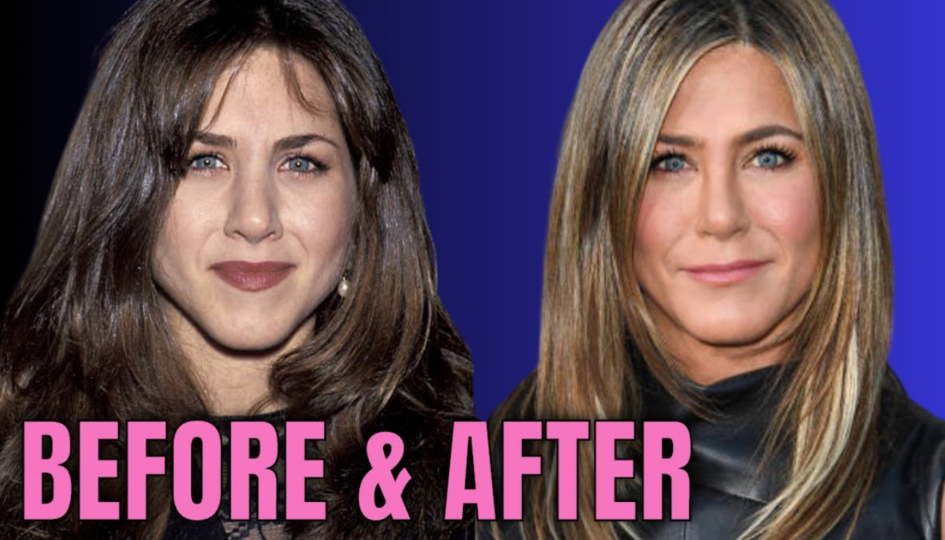 Jennifer Aniston Plastic Surgery: 8 Ageless Beauty Secrets Revealed in the USA