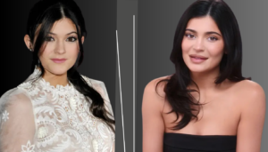 Kylie Jenner Plastic Surgery: A Look at Her Transformation Before & After