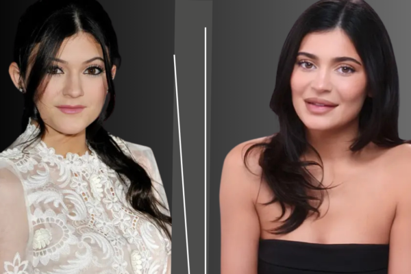 Kylie Jenner Plastic Surgery: A Look at Her Transformation Before & After