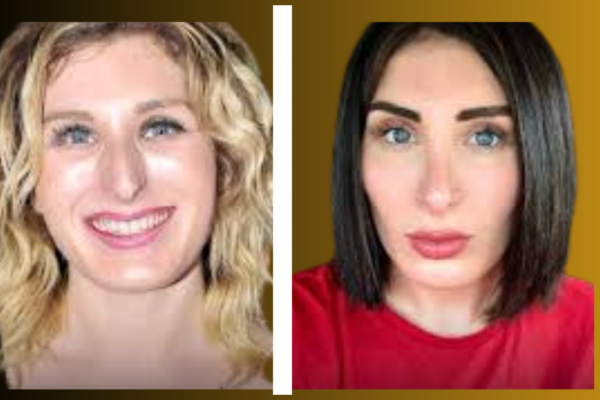 Laura Loomer Plastic Surgery