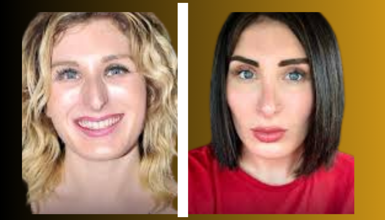 Laura Loomer Plastic Surgery