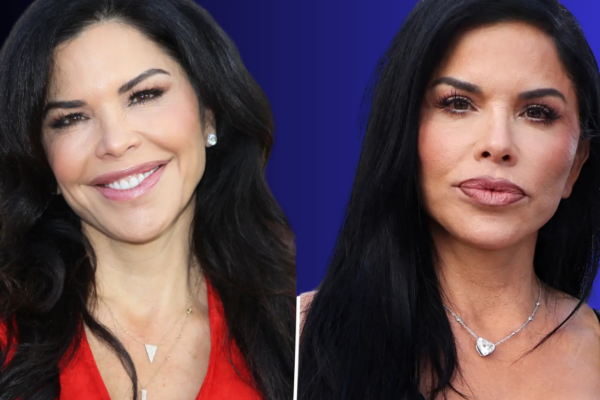 Lauren Sanchez Plastic Surgery: 9 Fascinating Details About Her Transformation in the USA