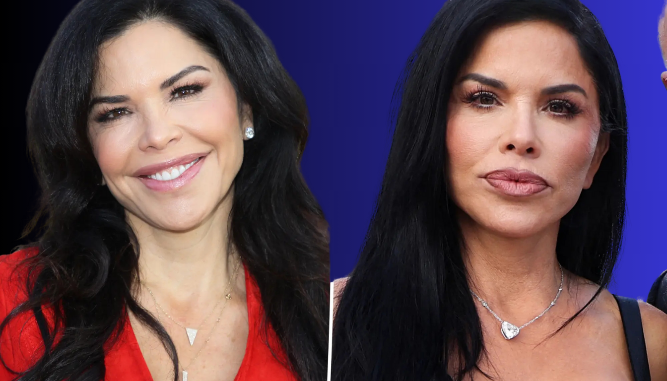 Lauren Sanchez Plastic Surgery: 9 Fascinating Details About Her Transformation in the USA