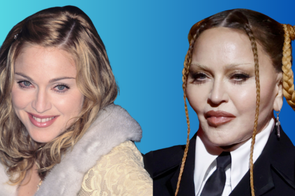 Madonna Plastic Surgery: Her Transformation and Controversial Beauty Journey