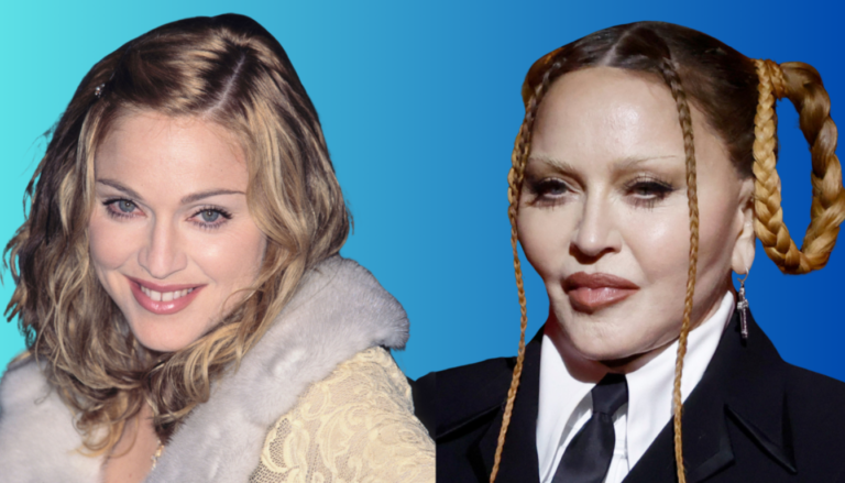 Madonna Plastic Surgery: Her Transformation and Controversial Beauty Journey