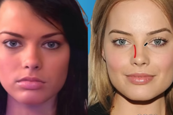 Margot Robbie Plastic Surgery: Separating Facts, Rumors, and the Truth Behind Her Look