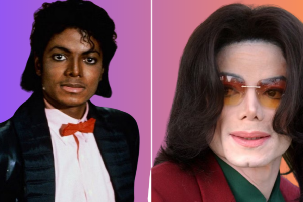 Michael Jackson Plastic Surgery: His Transformation Over the Years