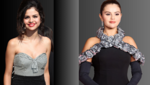 Selena Gomez Plastic Surgery: Truth Behind Her Transformation