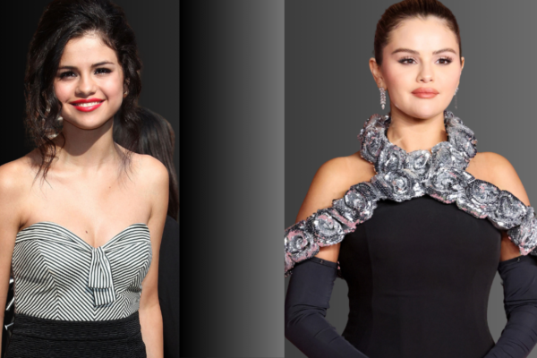 Selena Gomez Plastic Surgery: Truth Behind Her Transformation