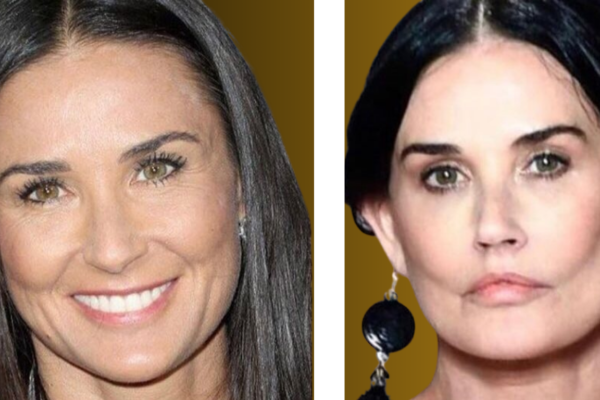 Demi Moore Plastic Surgery: Before and After Transformation Revealed